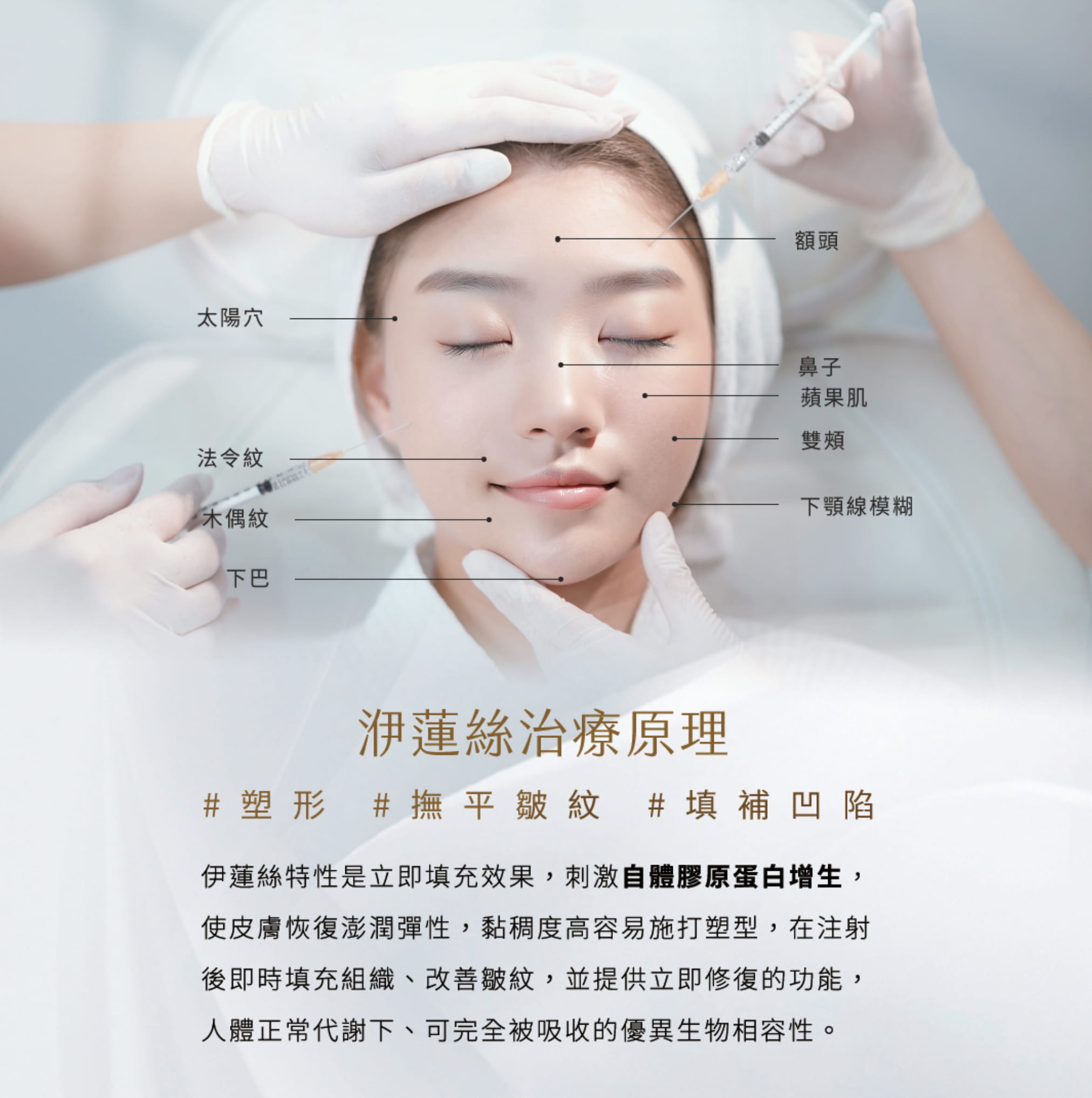 洢蓮絲注射區域的不同是影響消腫速度之一