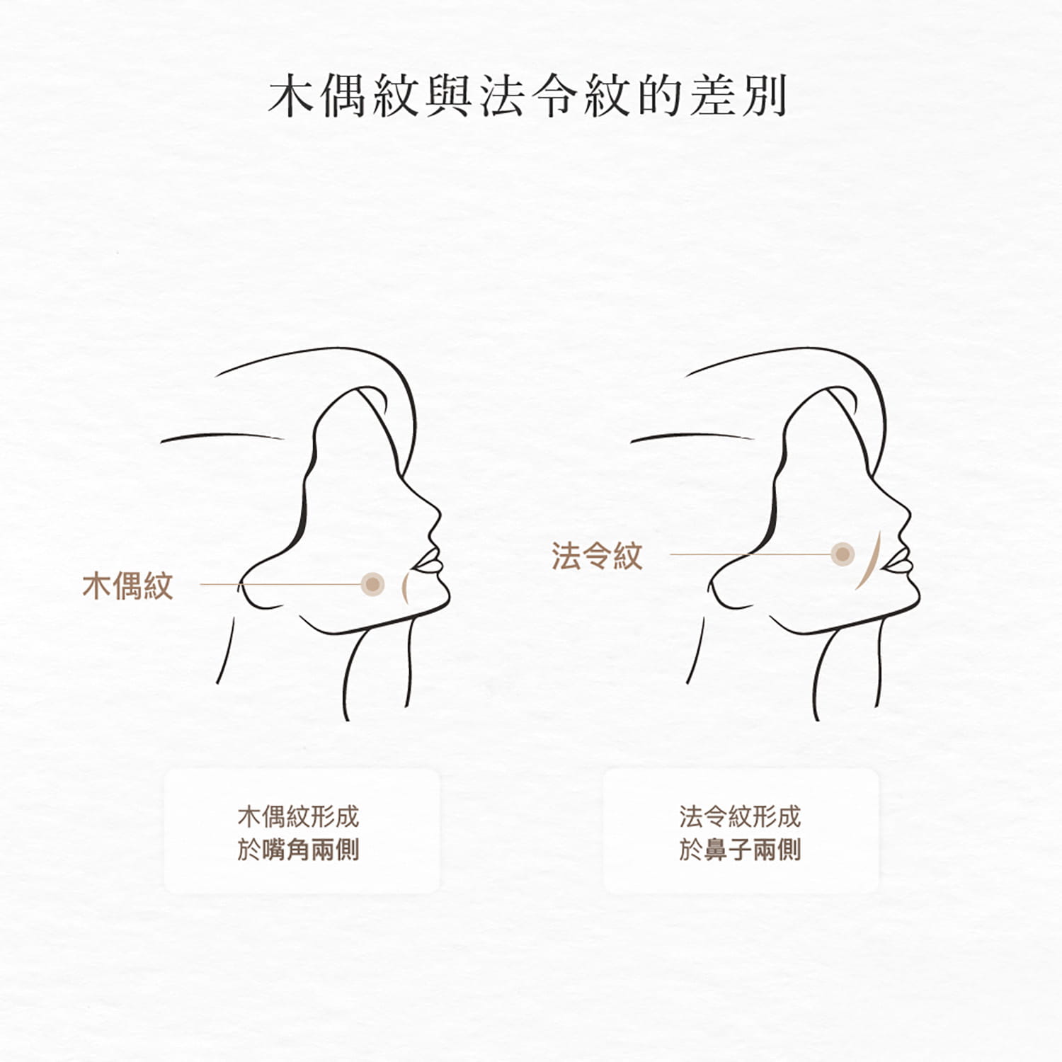木偶紋與法令紋的差別